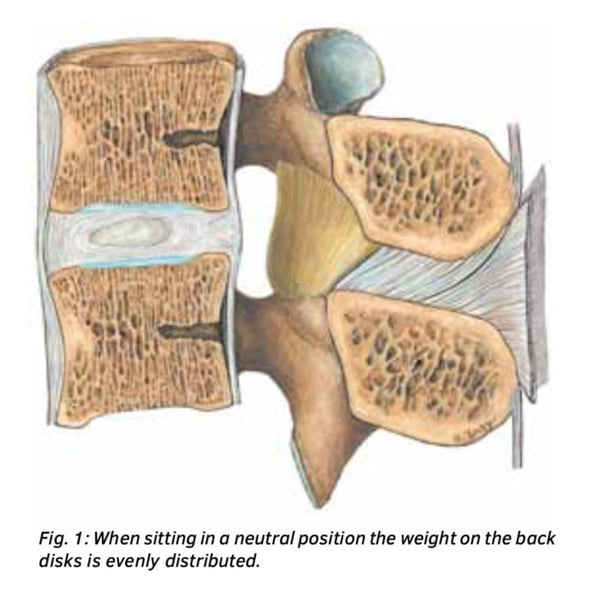 Proper Sitting Posture in the Dental Practice (use a saddle chair!)